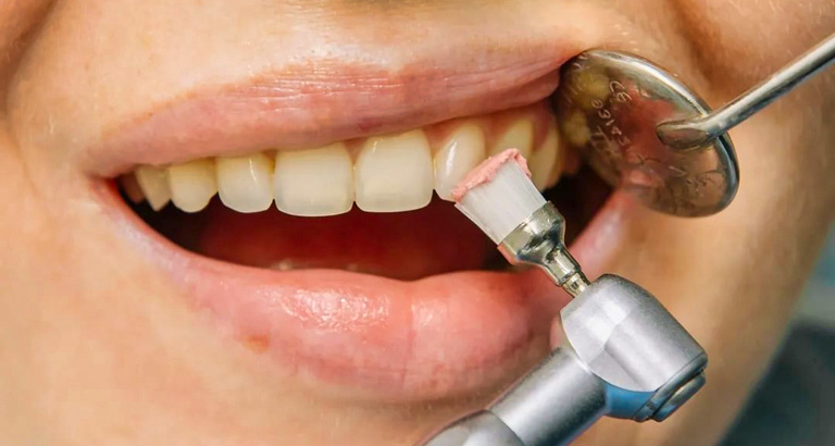 a routine dental check up and clean is generally covered by private health insurance.