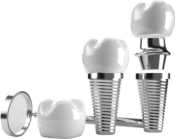 A set of dental implant components