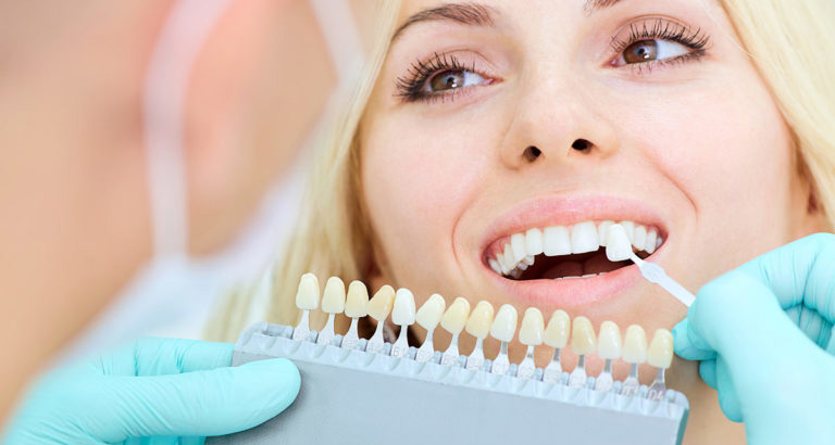 canley heights dentist showing dental implants